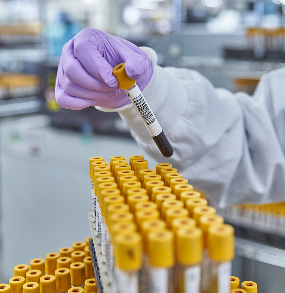 who should consider test